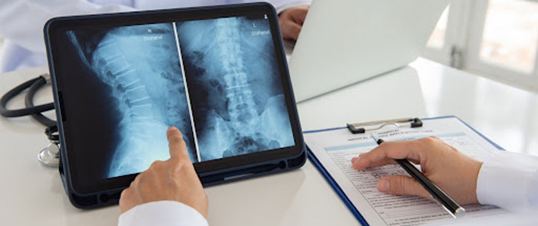 Albany spinal cord injury attorney